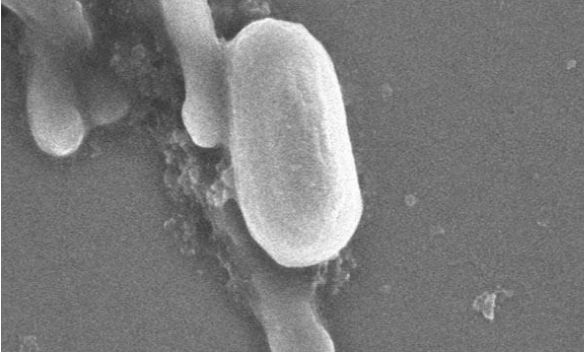 稀奇事|抗菌涂料可能会为细菌提供额外的保护